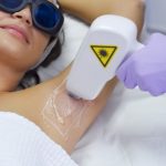 How Does Laser Hair Removal Work