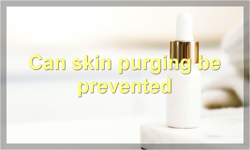 Can skin purging be prevented