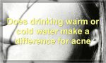 Does drinking warm or cold water make a difference for acne