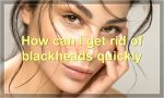 How can I get rid of blackheads quickly