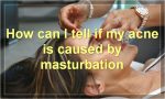 How can I tell if my acne is caused by masturbation