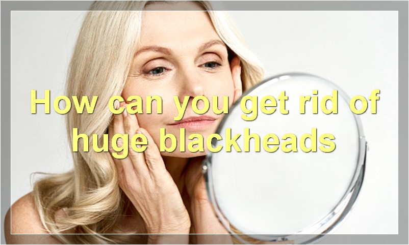 How can you get rid of huge blackheads