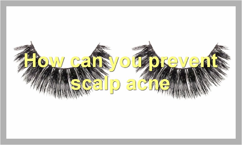 How can you prevent scalp acne