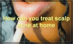 How can you treat scalp acne at home
