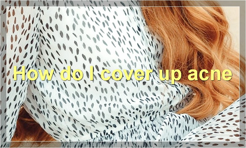 How do I cover up acne