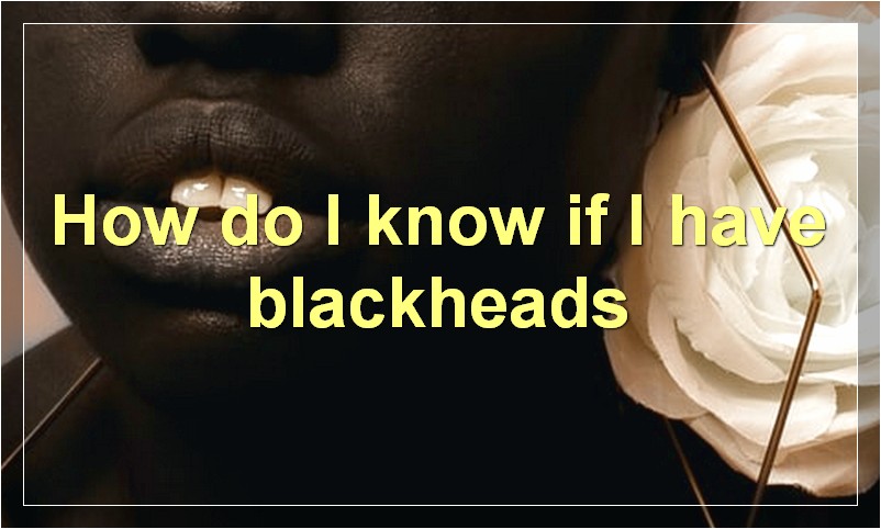 How do I know if I have blackheads