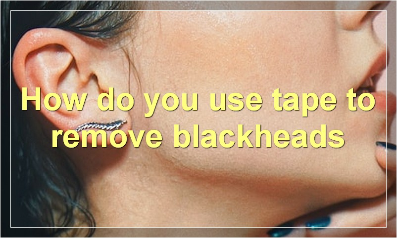 How do you use tape to remove blackheads