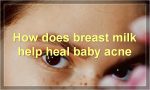 How does breast milk help heal baby acne