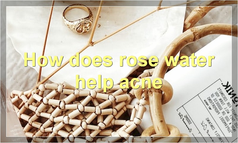How does rose water help acne