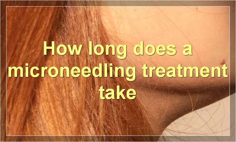 How long does a microneedling treatment take