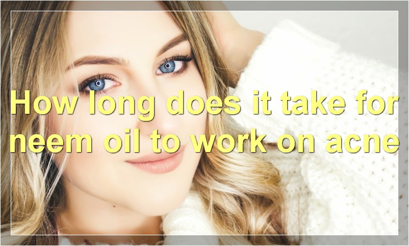 How long does it take for neem oil to work on acne