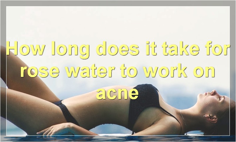 How long does it take for rose water to work on acne