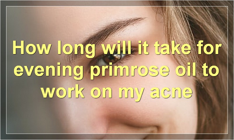 How long will it take for evening primrose oil to work on my acne