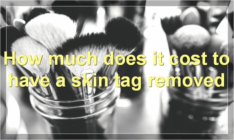 How much does it cost to have a skin tag removed