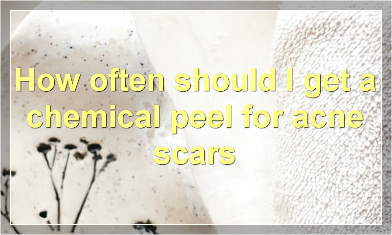How often should I get a chemical peel for acne scars