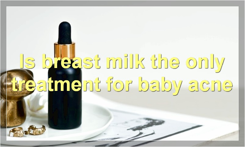 Is breast milk the only treatment for baby acne