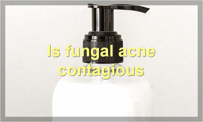 Is fungal acne contagious