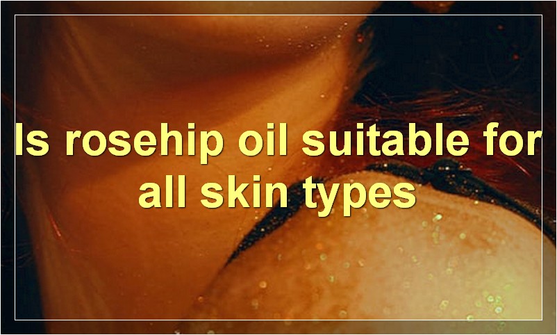 Is rosehip oil suitable for all skin types