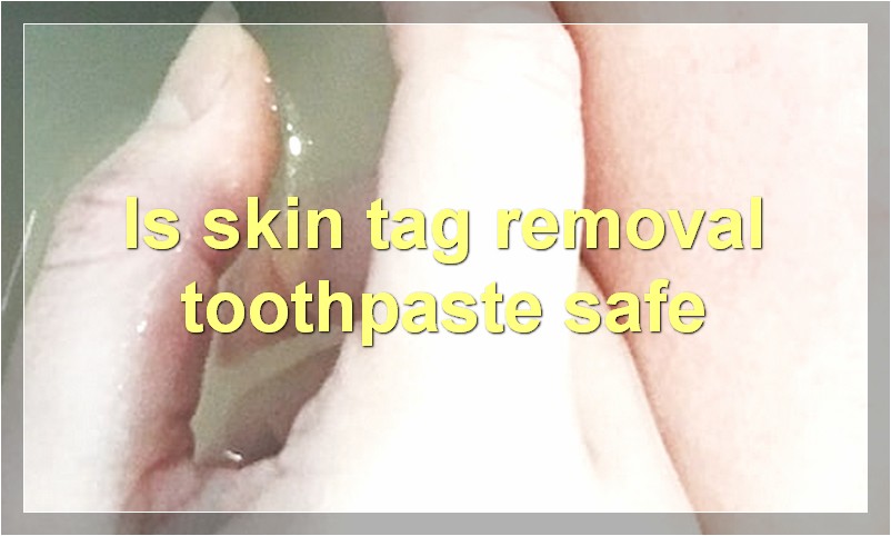 Is skin tag removal toothpaste safe