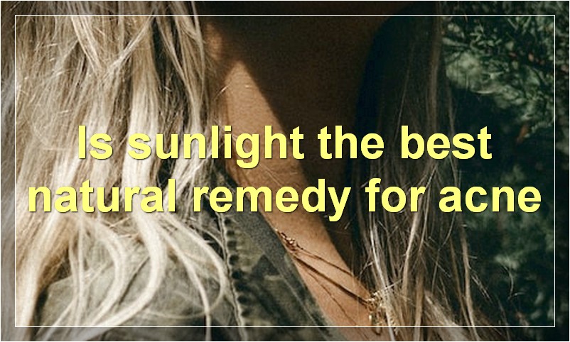 Is sunlight the best natural remedy for acne