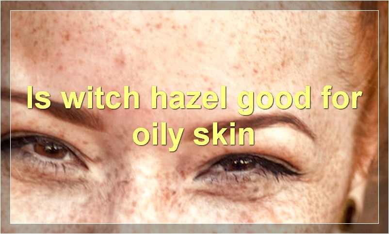 Is witch hazel good for oily skin