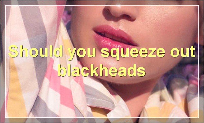 Should you squeeze out blackheads