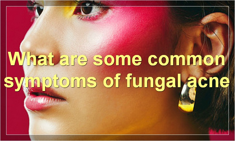 What are some common symptoms of fungal acne