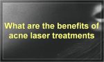 What are the benefits of acne laser treatments