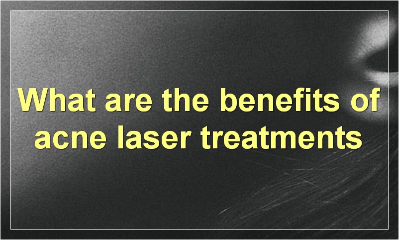 What are the benefits of acne laser treatments