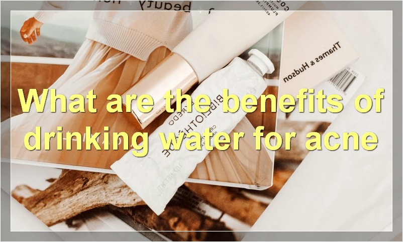 What are the benefits of drinking water for acne