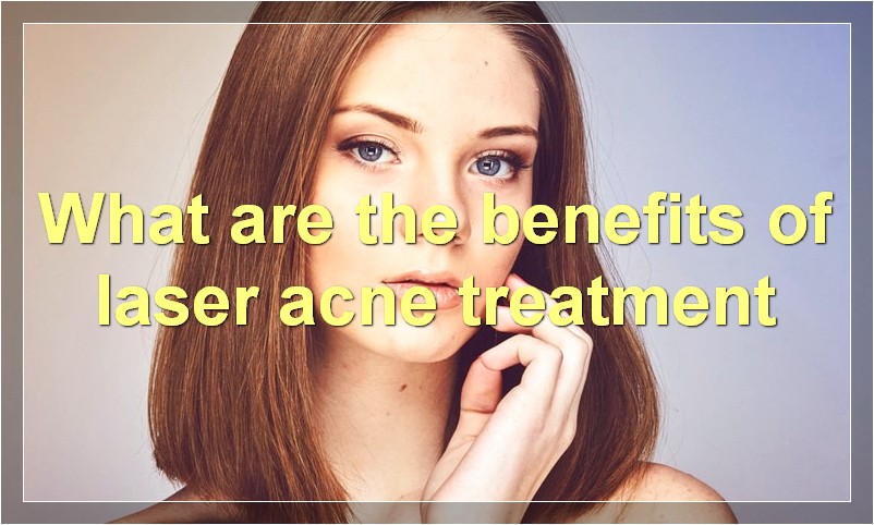 What are the benefits of laser acne treatment