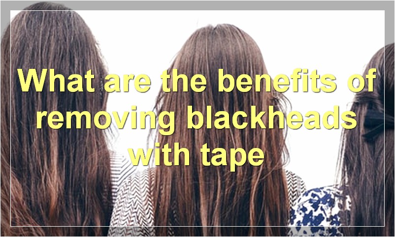 What are the benefits of removing blackheads with tape