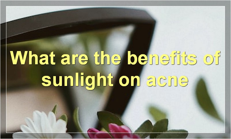 What are the benefits of sunlight on acne
