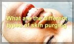 What are the different types of skin purging