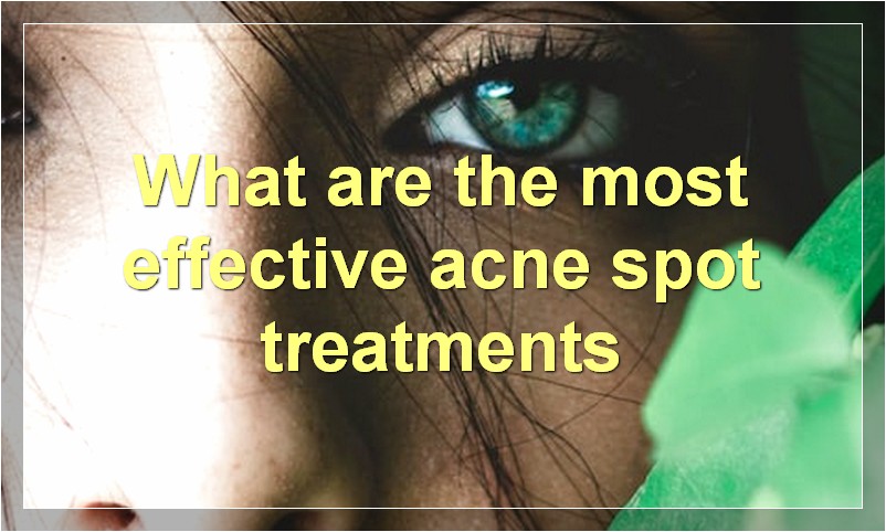 What are the most effective acne spot treatments