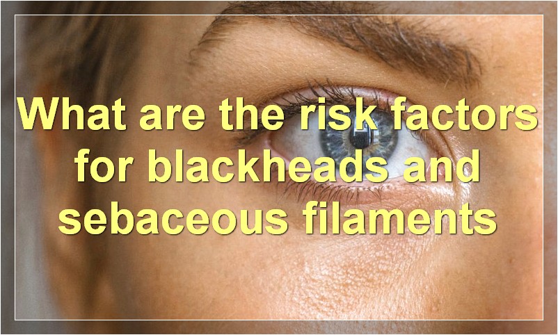 What are the risk factors for blackheads and sebaceous filaments