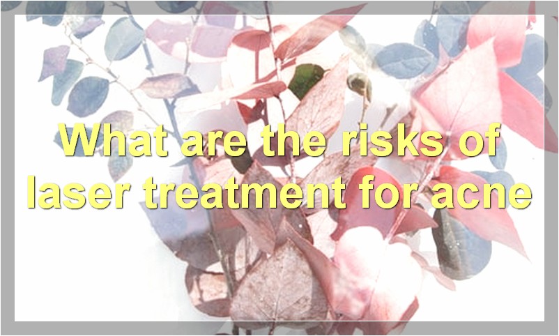 What are the risks of laser treatment for acne