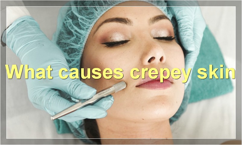 What causes crepey skin