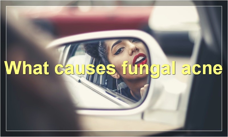 What causes fungal acne