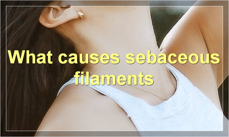 What causes sebaceous filaments