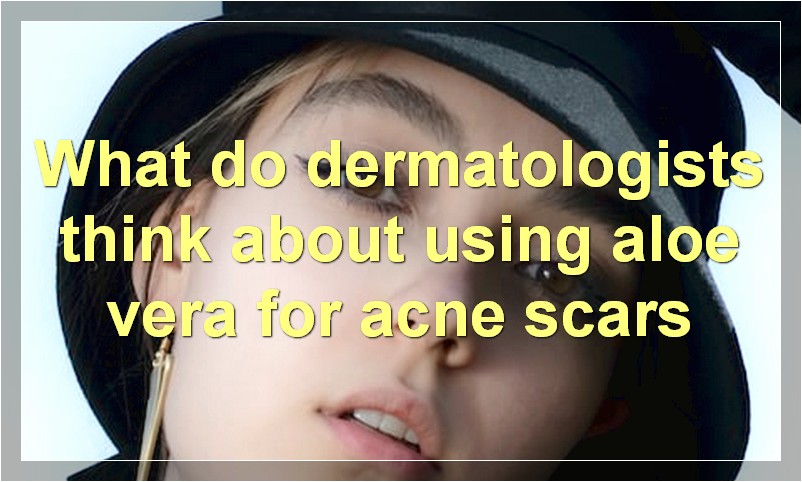 What do dermatologists think about using aloe vera for acne scars