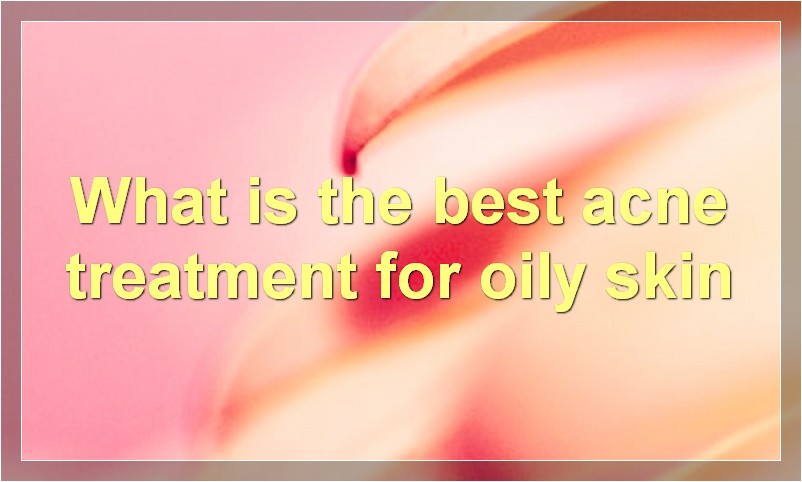 What is the best acne treatment for oily skin