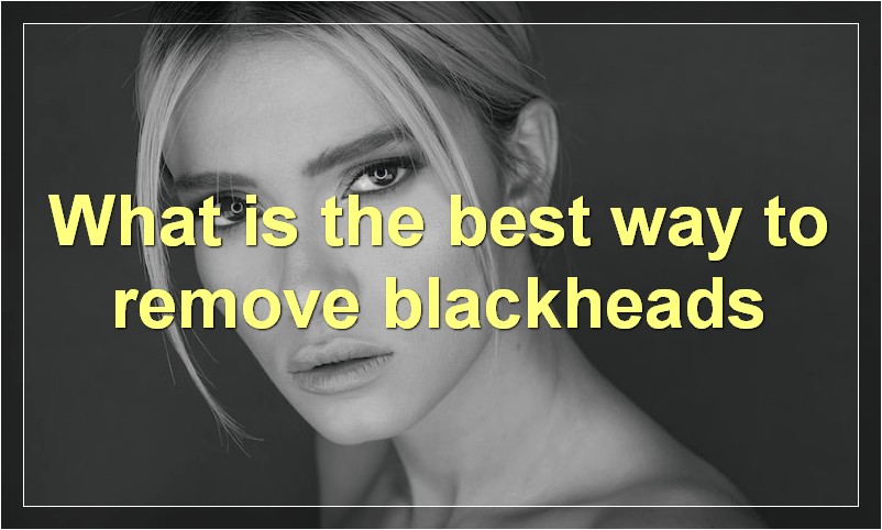 What is the best way to remove blackheads
