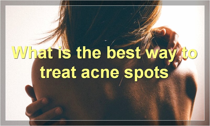 What is the best way to treat acne spots