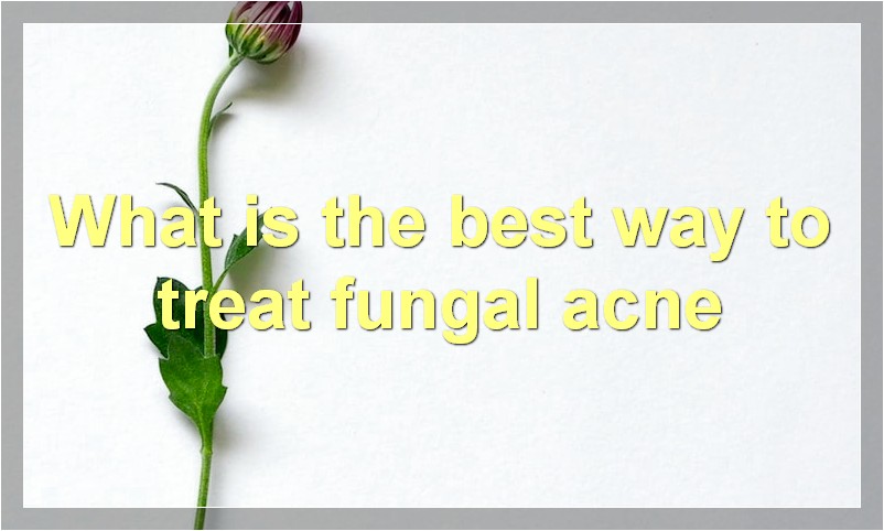 What is the best way to treat fungal acne