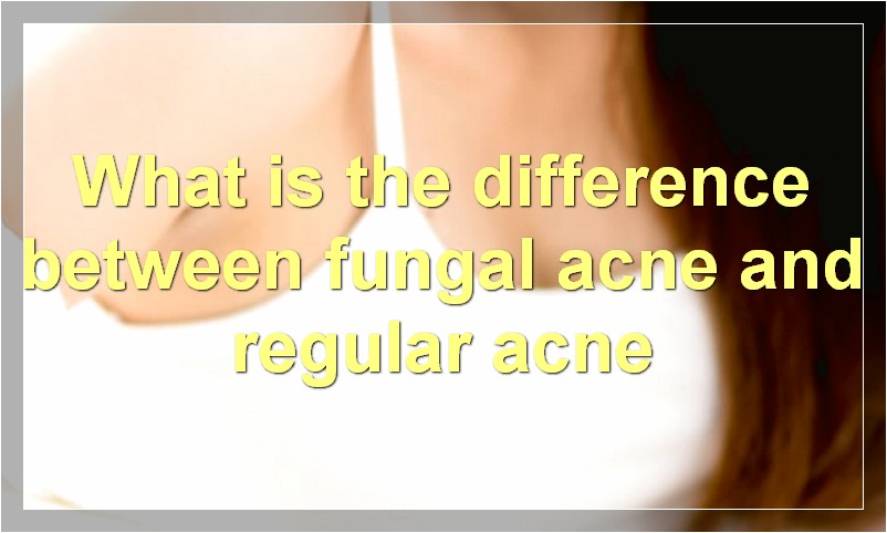 What is the difference between fungal acne and regular acne