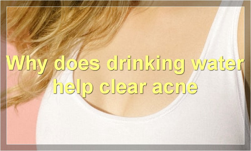 Why does drinking water help clear acne