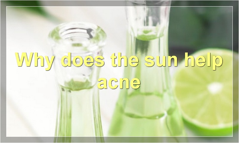 Why does the sun help acne