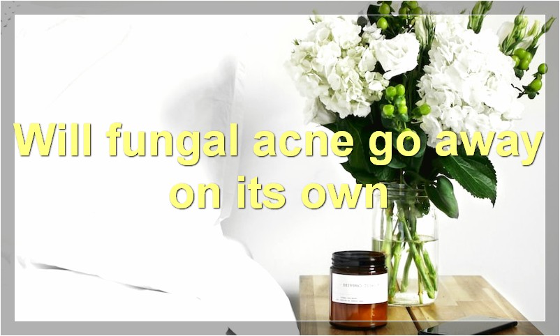 Will fungal acne go away on its own