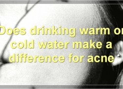The Benefits Of Drinking Water For Acne